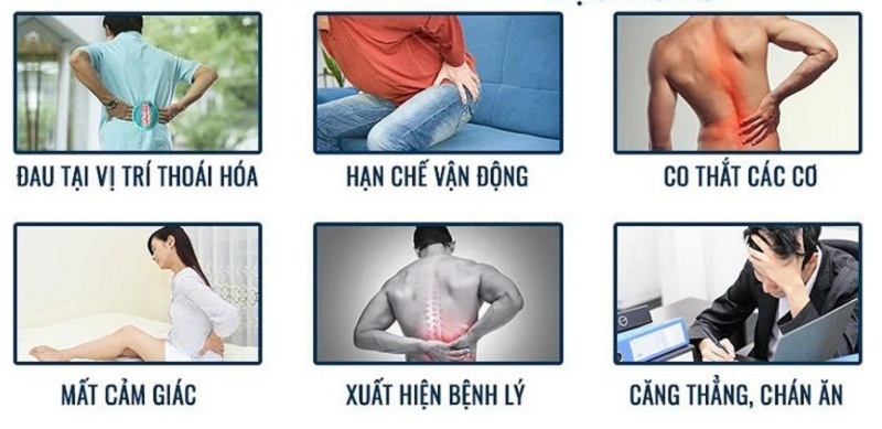 Những ảnh hưởng thoái hóa đốt sống thắt lưng