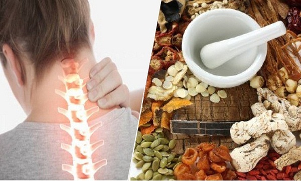 Điều trị thoái hóa đốt sống cổ bằng Đông y chậm mà chắc